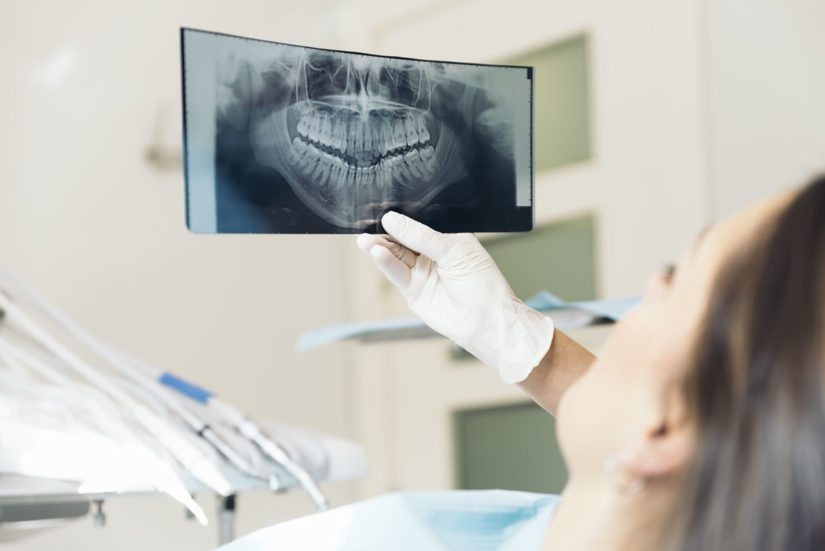 Dentist reviewing digital X-ray images of a patient's teeth